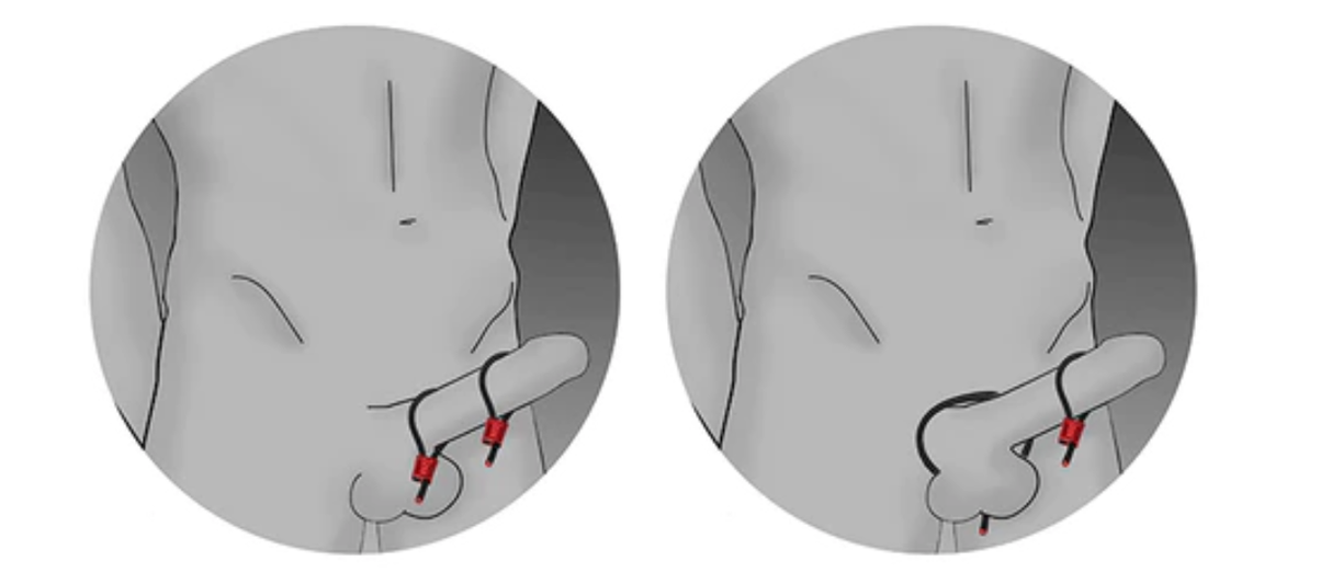 Electra Stim Prestige Electra Loops Adjustable Cock Ring